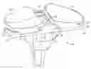 Fig. 01 - Anterior locking clip