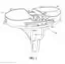 Fig. 03 - Anterior locking clip