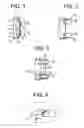 Fig. 02 - Expandable trials