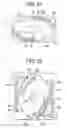 Fig. 11 - Expandable trials