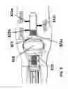 Fig. 11 - Insertion tool for implant and methods of use