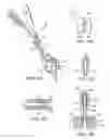 Fig. 05 - Methods and apparatus for intervertebral disc prosthesis insertion