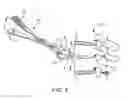 Fig. 06 - Methods and apparatus for intervertebral disc prosthesis insertion