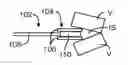Fig. 01 - Methods and apparatus for intervertebral disc prosthesis insertion