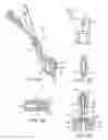 Fig. 05 - Methods and apparatus for intervertebral disc prosthesis insertion