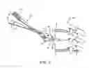Fig. 06 - Methods and apparatus for intervertebral disc prosthesis insertion
