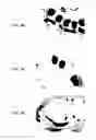 Fig. 18 - Stents having protruding drug-delivery features and associated systems and methods