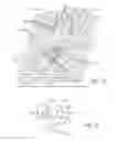 Fig. 16 - Highly flexible stent and method of manufacture