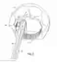 Fig. 04 - Vascular prosthetic delivery device and method of use