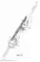Fig. 09 - Vascular prosthetic delivery device and method of use