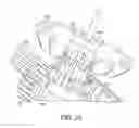 Fig. 18 - Vascular prosthetic delivery device and method of use