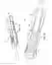Fig. 21 - Vascular prosthetic delivery device and method of use
