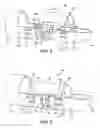 Fig. 03 - Device and method for fixation for bone or soft tissue deformity of digits