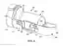Fig. 04 - Device and method for fixation for bone or soft tissue deformity of digits