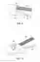 Fig. 08 - Device and method for fixation for bone or soft tissue deformity of digits