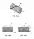 Fig. 13 - Device and method for fixation for bone or soft tissue deformity of digits