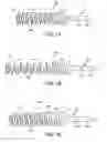 Fig. 15 - Device and method for fixation for bone or soft tissue deformity of digits