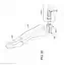 Fig. 23 - Device and method for fixation for bone or soft tissue deformity of digits
