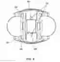 Fig. 05 - Devices and methods for pelvic organ prolapse alleviation