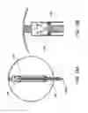 Fig. 20 - Devices and methods for pelvic organ prolapse alleviation