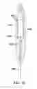 Fig. 22 - Devices and methods for pelvic organ prolapse alleviation