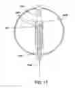 Fig. 23 - Devices and methods for pelvic organ prolapse alleviation