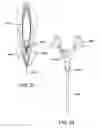 Fig. 28 - Devices and methods for pelvic organ prolapse alleviation