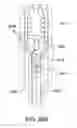 Fig. 30 - Devices and methods for pelvic organ prolapse alleviation