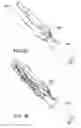 Fig. 37 - Devices and methods for pelvic organ prolapse alleviation