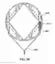 Fig. 43 - Devices and methods for pelvic organ prolapse alleviation