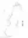 Fig. 12 - Intraocular delivery devices and methods therefor