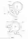 Fig. 34 - Intraocular delivery devices and methods therefor