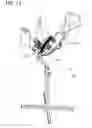 Fig. 15 - Orthosis for range of motion