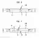 Fig. 04 - Spine mobilization system