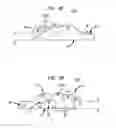Fig. 16 - Spine mobilization system