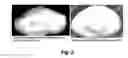Fig. 03 - LIGHTENING ACTIVE AGENT CONTAINING PLANT EXTRACTS, USES THEREOF AND COMPOSITIONS CONTAINING THE SAME