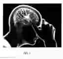 Fig. 02 - Method and system for preventing migraine headaches, cluster headaches and dizziness