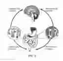 Fig. 04 - Method and system for preventing migraine headaches, cluster headaches and dizziness