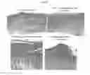 Fig. 15 - TOPICAL NANOEMULSION THERAPY FOR WOUNDS