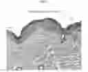 Fig. 18 - TOPICAL NANOEMULSION THERAPY FOR WOUNDS