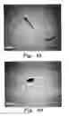Fig. 05 - Method of treating diabetic wounds using biosynthesized nanoparticles