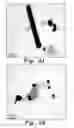 Fig. 09 - Method of treating diabetic wounds using biosynthesized nanoparticles