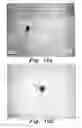 Fig. 12 - Method of treating diabetic wounds using biosynthesized nanoparticles