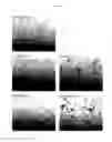 Fig. 02 - Pharmaceutical compositions comprising one or more pyrone compounds, and their use for treating inflammatory and neurodegenerative diseases
