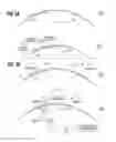 Fig. 04 - Compositions, packaged pharmaceuticals, and methods of using hedgehog pathway modulators for the sensitization of resistant tumors