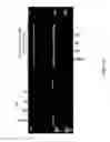 Fig. 21 - 2,4-disubstituted pyrimidines useful as kinase inhibitors
