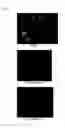 Fig. 02 - Therapeutic agent for ocular fundus disease