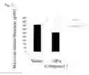 Fig. 12 - Therapeutic agent for ocular fundus disease