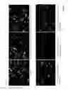 Fig. 13 - Therapeutic agent for ocular fundus disease