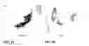 Fig. 04 - Method of treating acute coronary syndromes